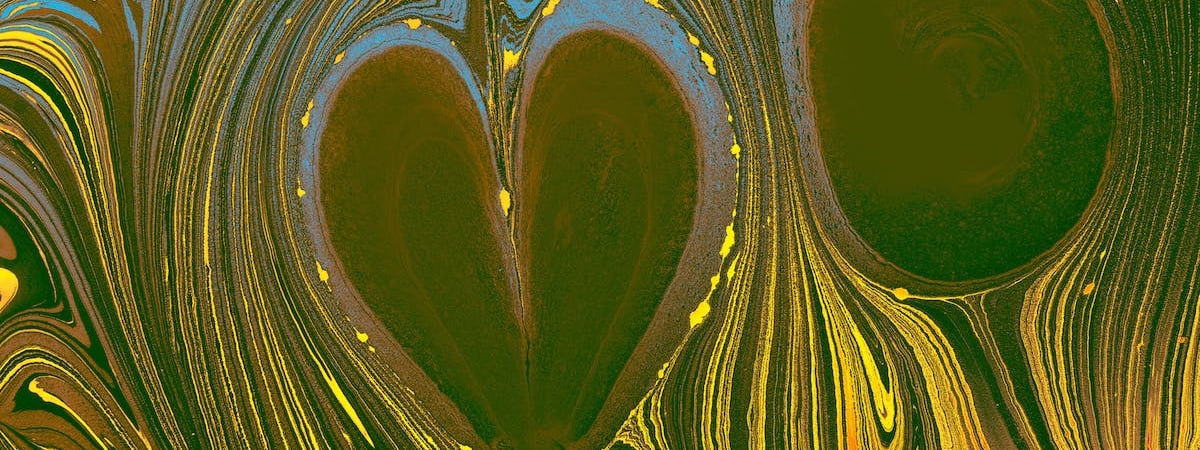 Причиной смерти Игоря Ледника стала остановка сердца