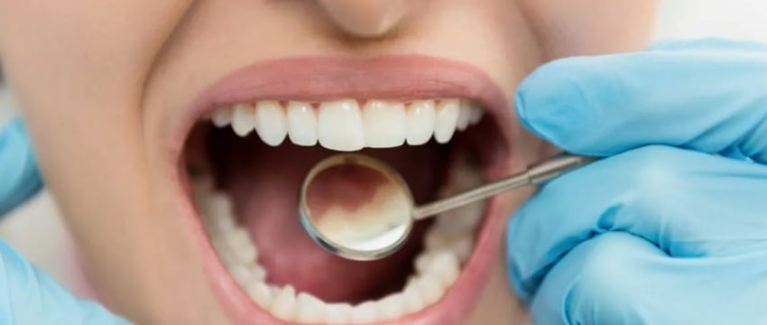 В Беларуси разрабатывают вакцину от кариеса