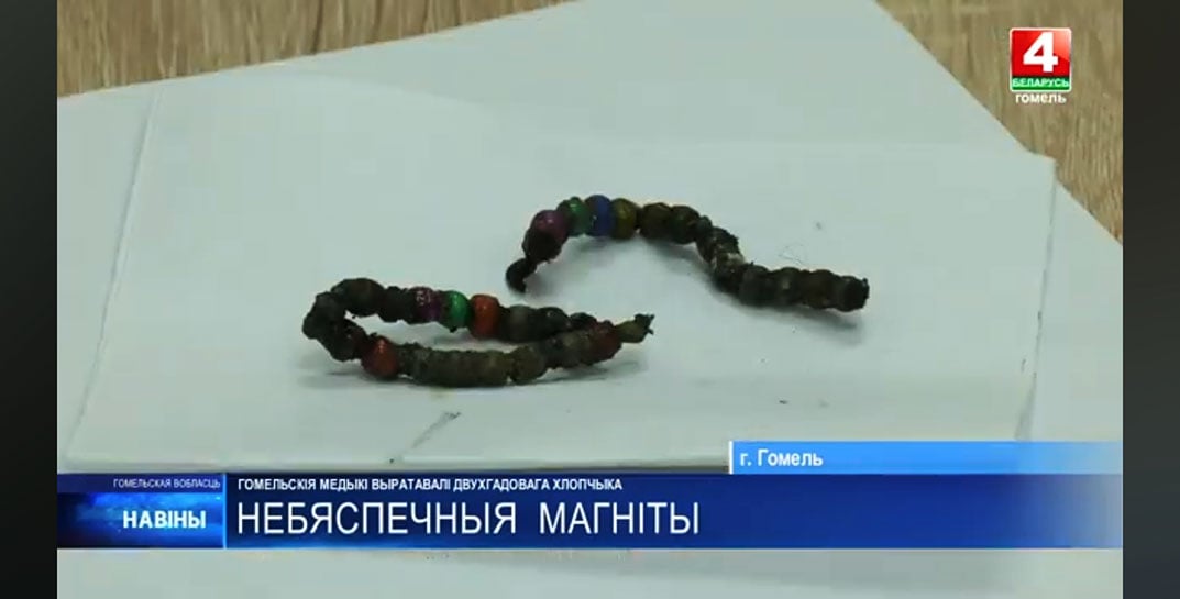 В Добруше 2-летний мальчик съел 20 магнитов — пришлось вырезать часть кишечника