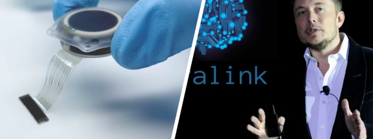 Вернёт зрение ослепшим? В США одобрили испытания на людях нового «прорывного» имплантата компании Neuralink