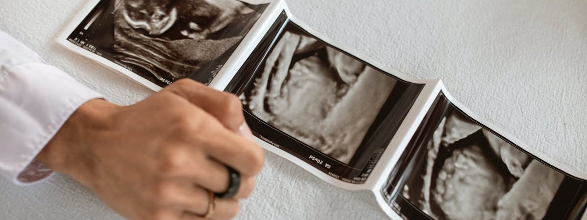 Ожидаемая продолжительность жизни в ЕС превысила показатели до пандемии коронавируса