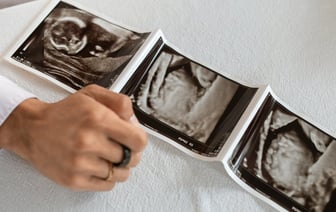 Ожидаемая продолжительность жизни в ЕС превысила показатели до пандемии коронавируса