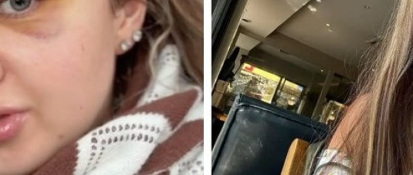 Помните белоруску, которая сделала пересадку бровей? Вот как все выглядит сейчас