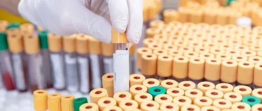 Сотни образцов смертельных вирусов пропали в Австралии
