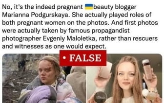 Девушка, которая выжила после удара по роддому в Мариуполе, а ее снимок разошелся по мировым СМИ, теперь агитирует за Путина