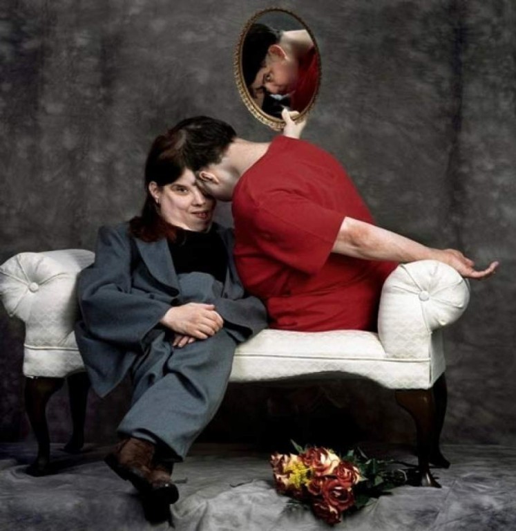 Старейшие сиамские близнецы Лори и Джордж Шаппелл скончались в США