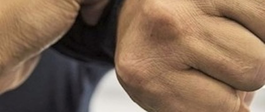 Сломал знакомому несколько ребер.  Эту новогоднюю историю белорус запомнит надолго