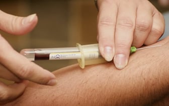 Анализ Крови Может Выявить Редкие Формы Слабоумия, Неврологические Заболевания: Исследование