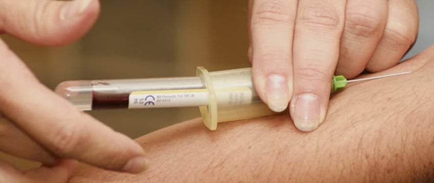 Анализ Крови Может Выявить Редкие Формы Слабоумия, Неврологические Заболевания: Исследование