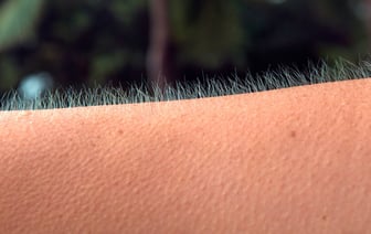 У вас бывают «мурашки» по коже? Врач рассказывает, что это может быть симптомом заболеваний