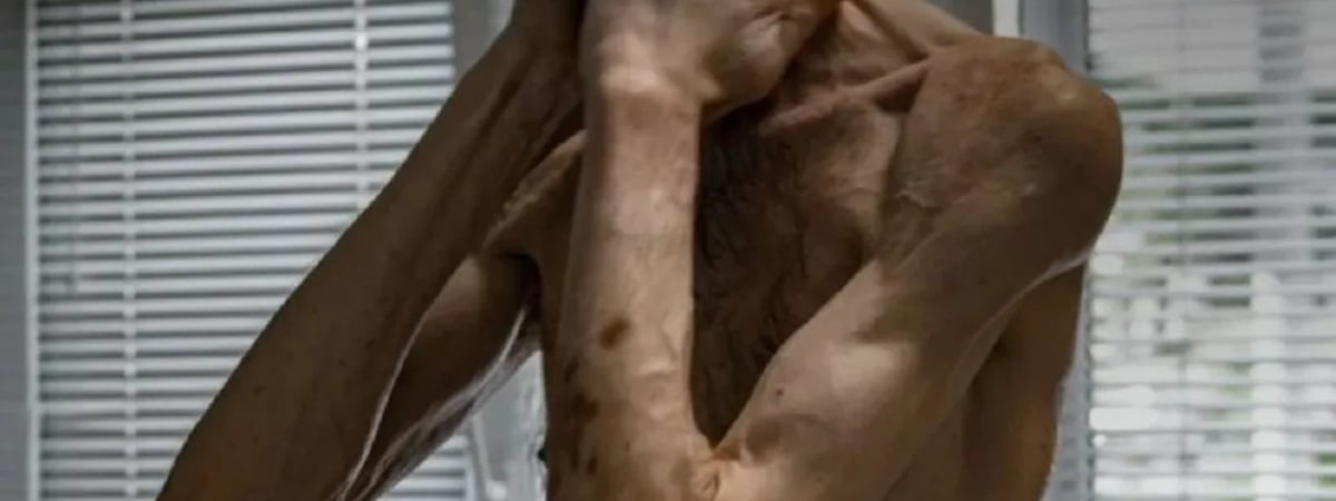 Как выглядит украинец после двух лет российского плена