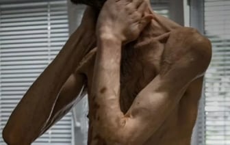 Как выглядит украинец после двух лет российского плена