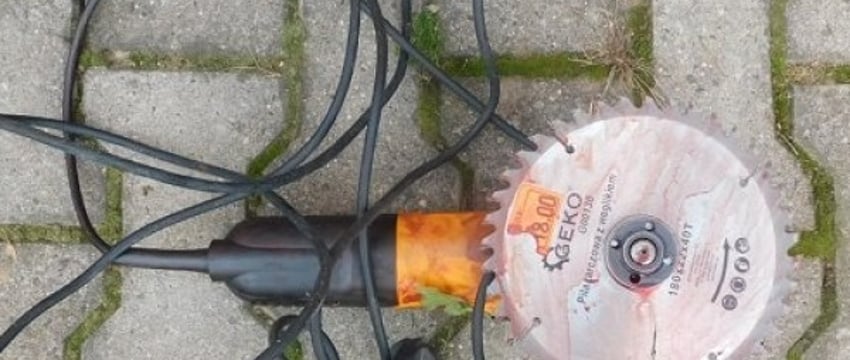 Жуткая смерть: белорус пилил дрова и раскроил себе шею