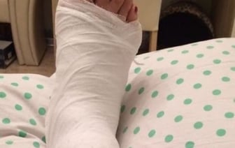 Белоруска поскользнулась на льду, получила травму и подала в суд. Ей выплатили солидную компенсацию