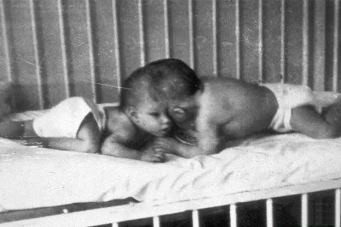 Старейшие сиамские близнецы Лори и Джордж Шаппелл скончались в США