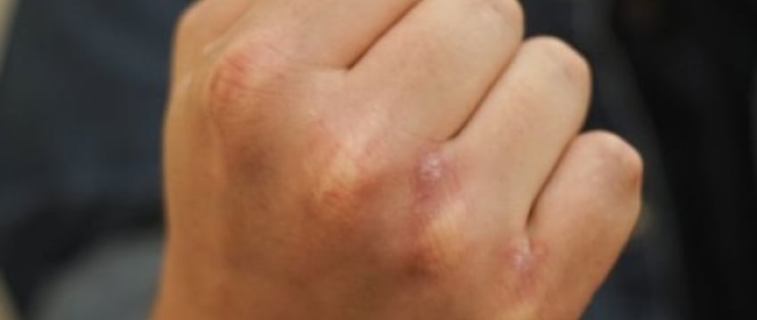 Инцидент в Брестской области: житель избил тракториста из-за шума