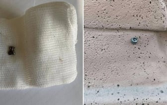 Белорус стрелял из пневматики по деревьям, а попал по 3-летней девочке — возбуждено дело