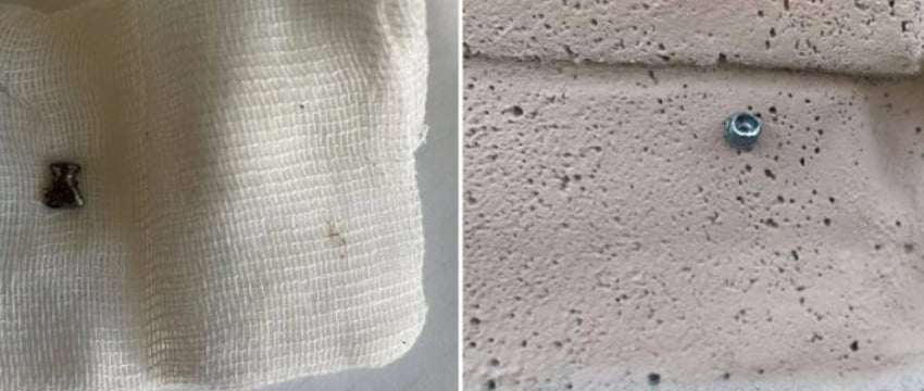 Белорус стрелял из пневматики по деревьям, а попал по 3-летней девочке — возбуждено дело