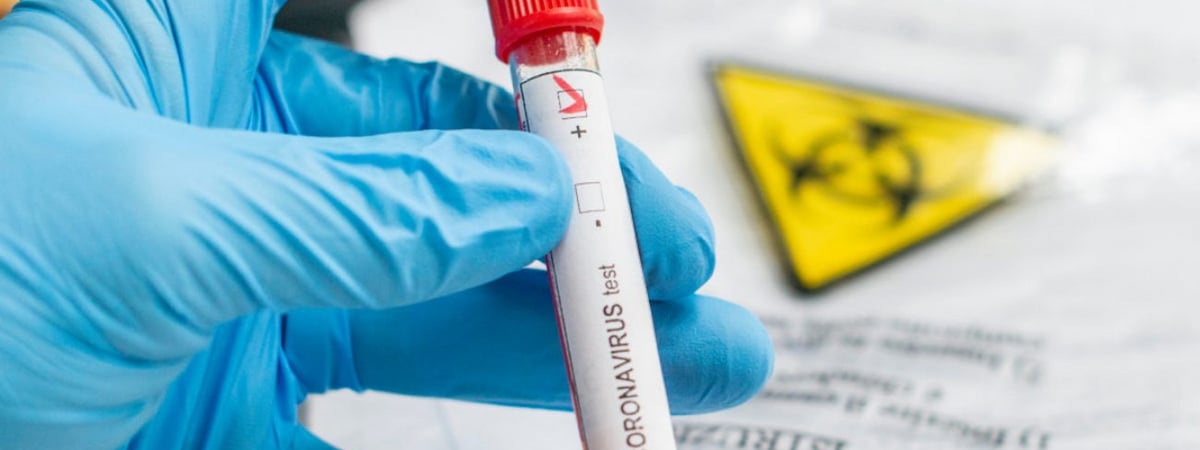 В Беларуси выявили новый вариант коронавируса