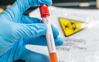 В Беларуси выявили новый вариант коронавируса