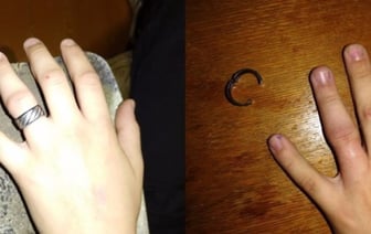 В Брестской области ребенок надел кольцо, но не смог его снять. Чем всё закончилось?
