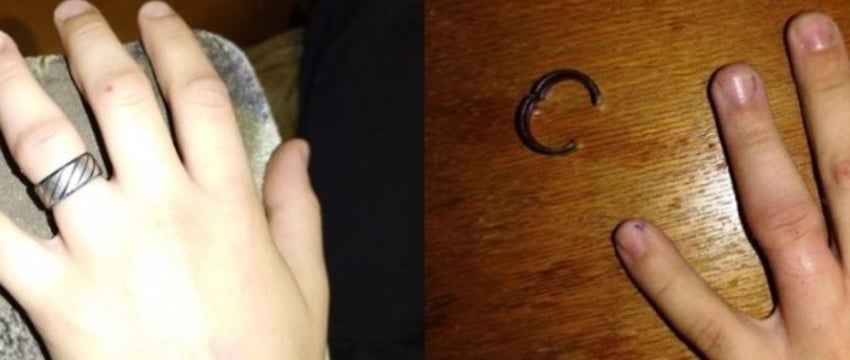 В Брестской области ребенок надел кольцо, но не смог его снять. Чем всё закончилось?