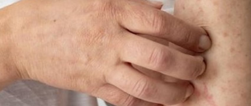 В Жабинковском районе зафиксирован случай заболевания корью