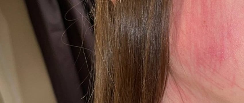 Белоруска пожаловалась, что пострадала в дорожном конфликте. Что говорит другая сторона?