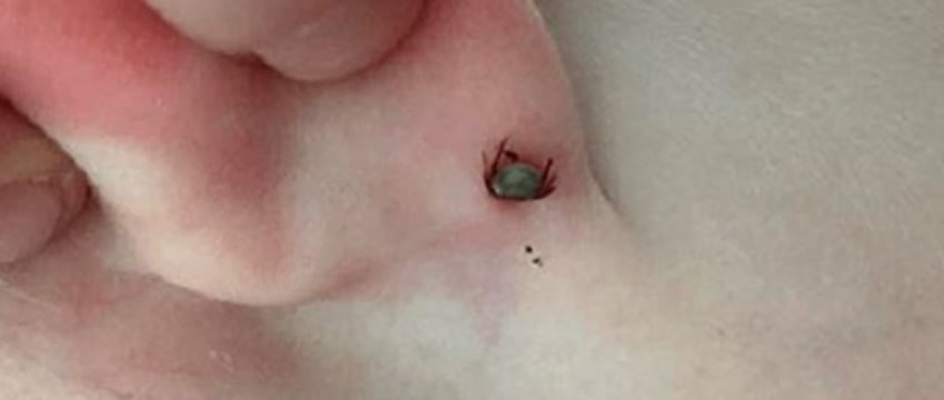 Исследование предпочтений клещей по группе крови человека