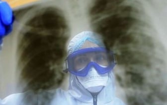 «Я курю вейпы, они безопасны» — и другие мифы о раке легкого