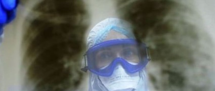 «Я курю вейпы, они безопасны» — и другие мифы о раке легкого