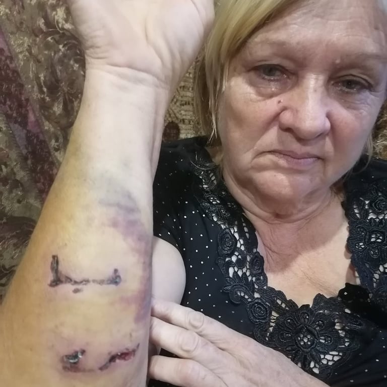 Осторожно, злые соседи. Односельчане стали врагами после нападения собаки