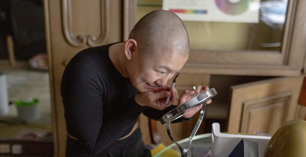 Ученые забили тревогу из-за роста случаев рака среди молодежи