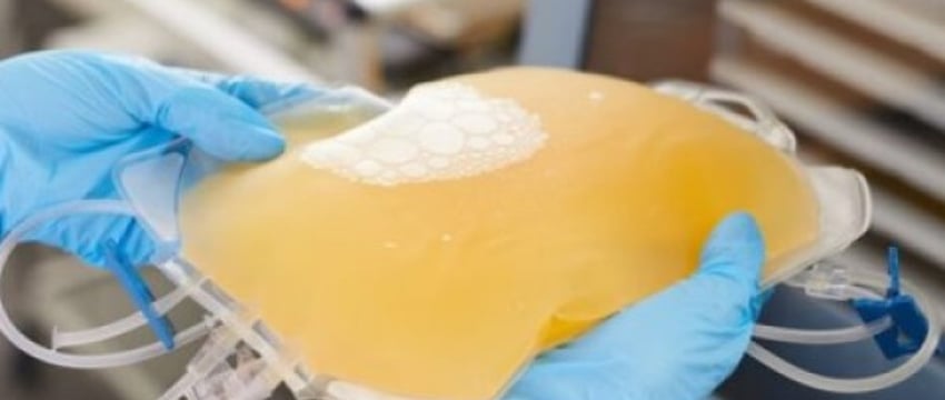 В Ганцевичах появится новый завод по производству препаратов из плазмы — первый подобный в СНГ