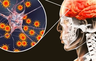 Борьба с менингитом: важность профилактики и защиты