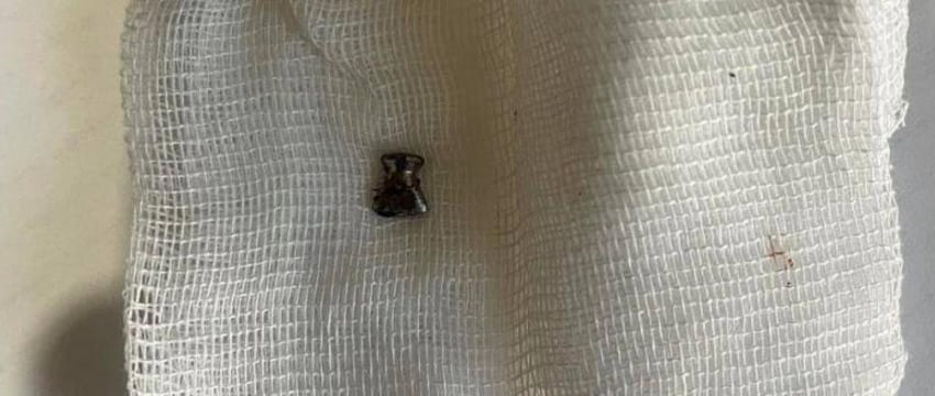 Мужчина стрелял из пневматики по деревьям и ранил 3-летнюю девочку