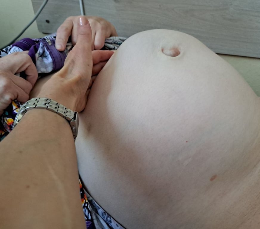 «Такие новообразования редкость». В Беларуси пациентке удалили огромную опухоль в 6 килограмм