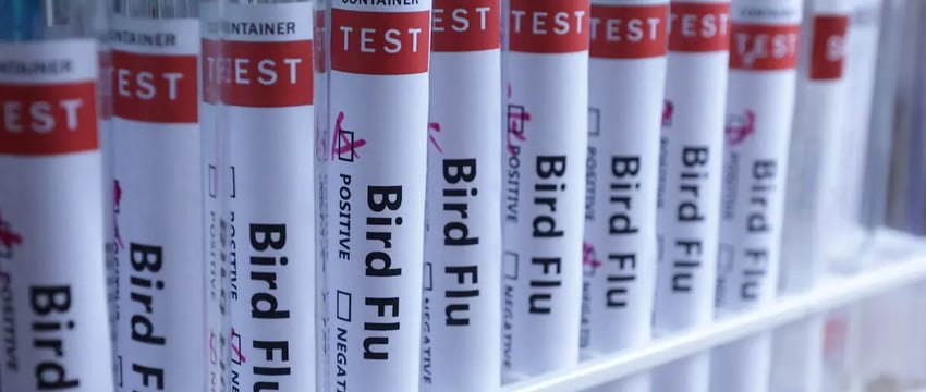 В США подтвержден первый случай заболевания птичьим гриппом без контакта с животными