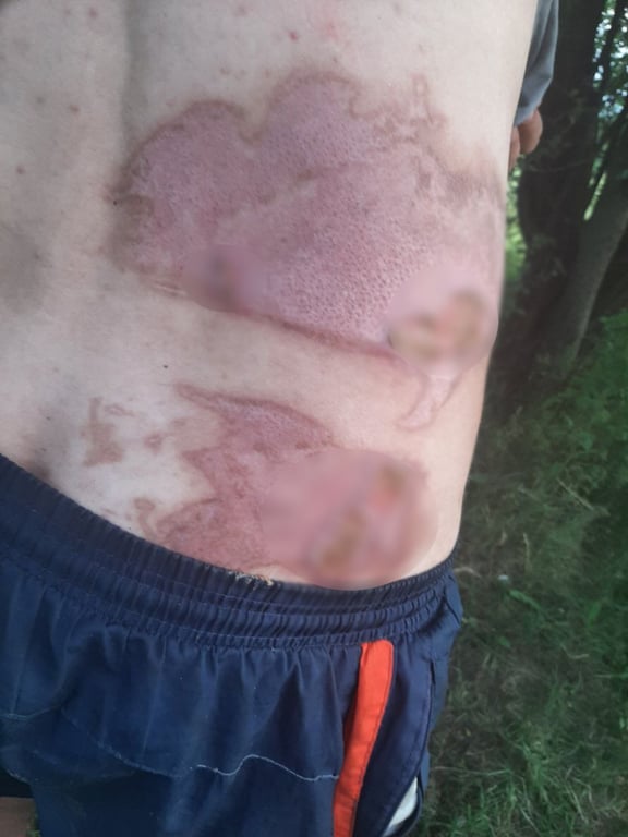 Белорусу в TikTok попалось видео, где он спит на вечеринке с горящей футболкой