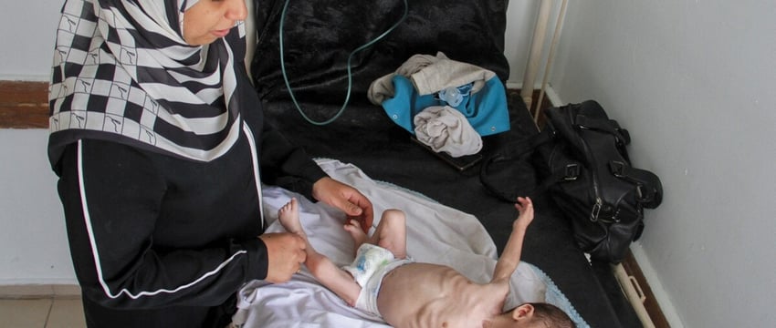 Children Starve As Millions Of Gaza Inhabitants Face Famine Threat