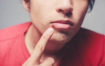 Как быстро избавиться от герпеса? Вот 5 народных рецептов, которые действительно работают — Полезно