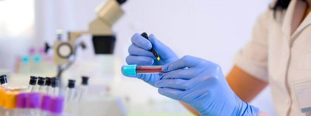 Минздрав Беларуси утвердил новые максимальные тарифы на платные лабораторные анализы — Официально