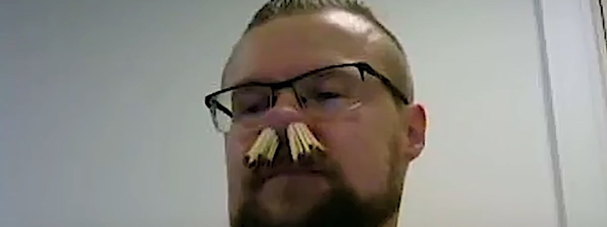 Мужчина засунул себе в нос 68 спичек. Зачем? — Видео