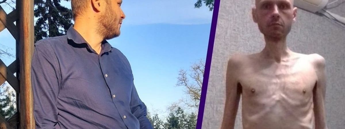 Минус 38 кг. Как выглядит украинский военный, вернувшийся из российского плена