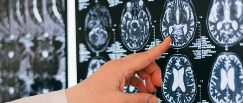 Ученые разрабатывают инструмент распознавания речи для прогнозирования развития болезни Альцгеймера.