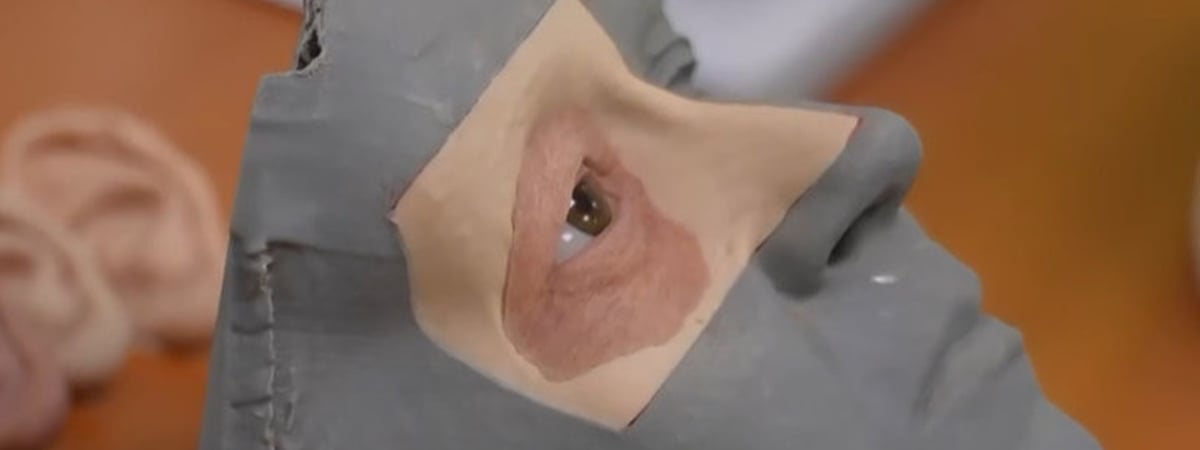 "Мы сканируем лицо, а потом можем его напечатать". Как украинский врач создает лицевые протезы для раненых военных