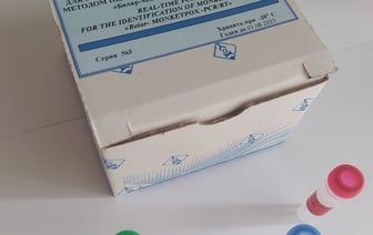 В мире растет количество зараженных оспой обезьян — а что в Беларуси