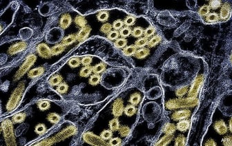 У двухлетней австралийской девочки обнаружен положительный результат теста на птичий грипп H5N1: ВОЗ