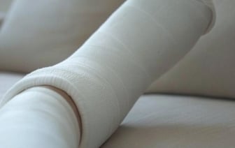 В Беларуси мужчина сломал ногу на работе, а по документам оказался прогульщиком. Подробности истории