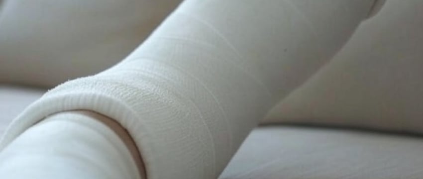 В Беларуси мужчина сломал ногу на работе, а по документам оказался прогульщиком. Подробности истории